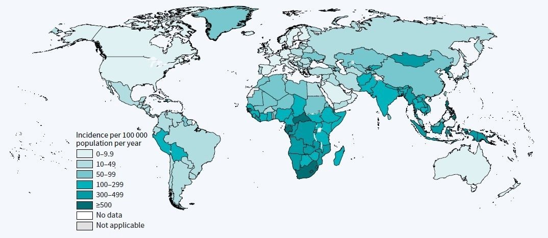 Estimated TB incidence rates, 2021