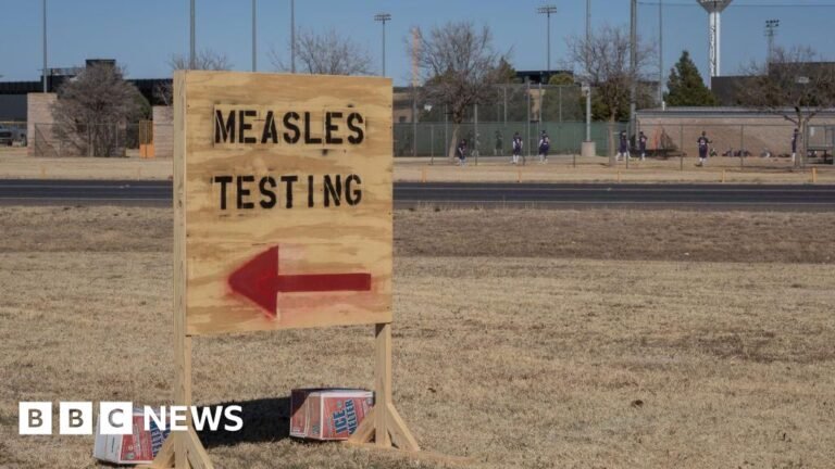 Second child dies of measles as western Texas outbreak worsens
