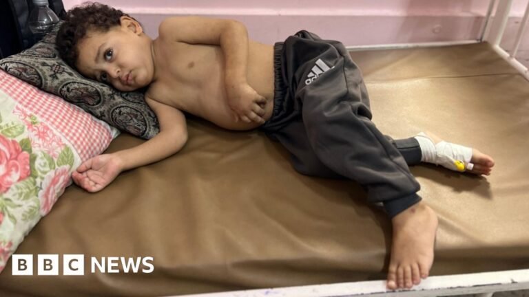 Gaza children dying as they wait for Israel to enable evacuations Gaza children dying as they wait for Israel to enable evacuations