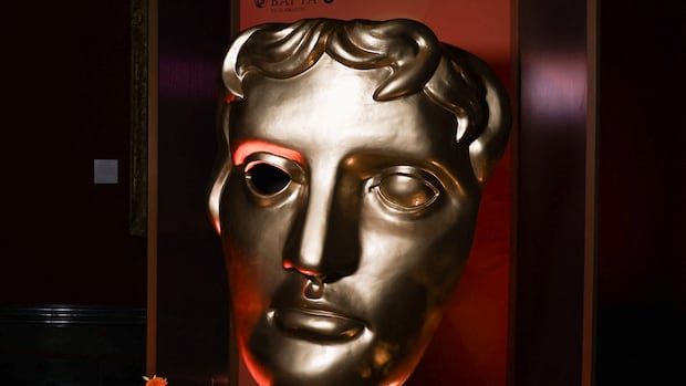 N-word shouted by a guest upended BAFTAs. We explain the medical condition behind outbursts N-word shouted by a guest upended BAFTAs. We explain the medical condition behind outbursts