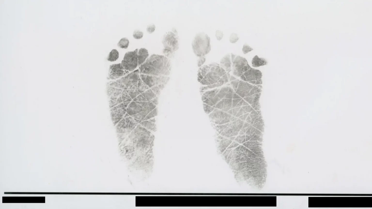 What I Learned About Vitamin K Deficiency From Babies’ Autopsy Reports — ProPublica