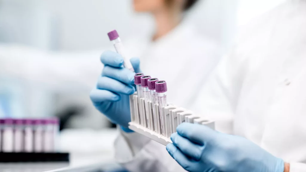 Frontiers | HIV treatment default in sub-Saharan Africa: issues and possible solutions