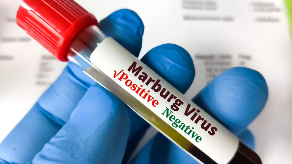 Uganda Reports Child Death From Marburg Virus Disease: How to Prevent Infection